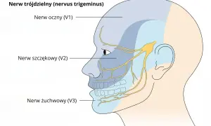 Schematyczny rysunek głowy z zaznaczonymi obszarami unerwienia nerwu trójdzielnego: nerw oczny (V1), szczękowy (V2) i żuchwowy (V3).