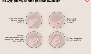 Ilustracja pokazuje zmiany wydzieliny pochwowej w cyklu, w tym co to owulacja i jak wygląda wydzielina w jej trakcie – jest wtedy bardzo wilgotna i elastyczna.