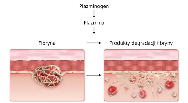 Schemat procesu koagulacji: plazminogen przekształca się w plazminę, która rozkłada fibrynę na produkty degradacji.