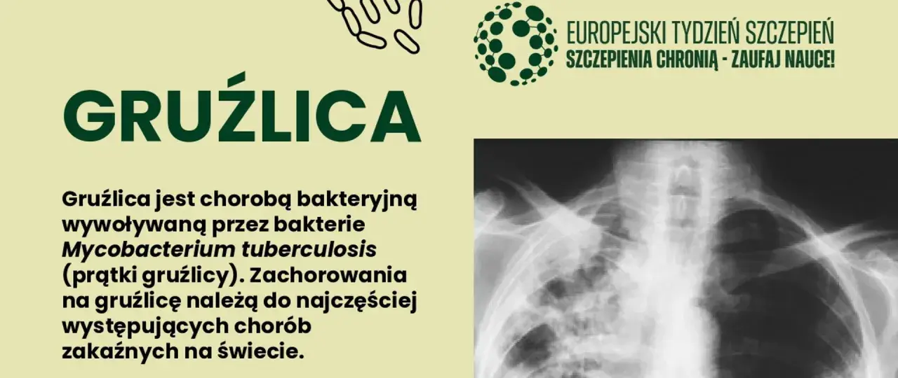 Gruźlica to choroba bakteryjna. Na zdjęciu RTG klatki piersiowej widoczne są zmiany typowe dla gruźlicy.